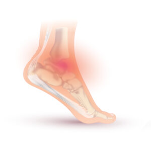 Ankle pain