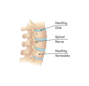 Healthy spine