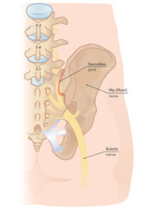 Sacroiliac joint