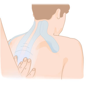 Trapezius pain taping