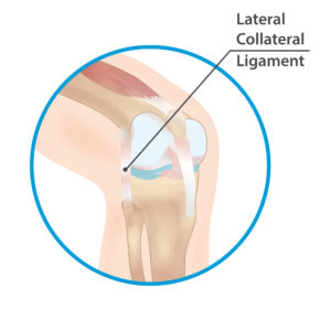 Lateral collateral ligament